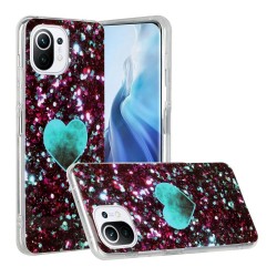 SKALO Xiaomi Mi 11 Lite...